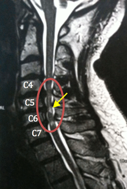 Coupe sagittale d’IRM